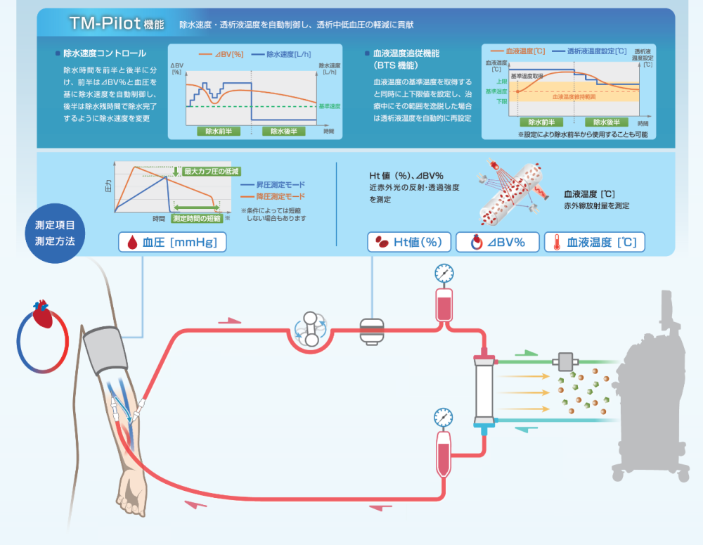 TM-Pilot（除水速度を自動でナビゲートする機能）を導入しました